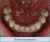 Before treatment