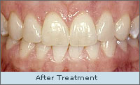 After treatment
