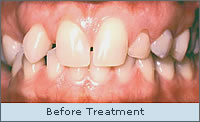 Before treatment